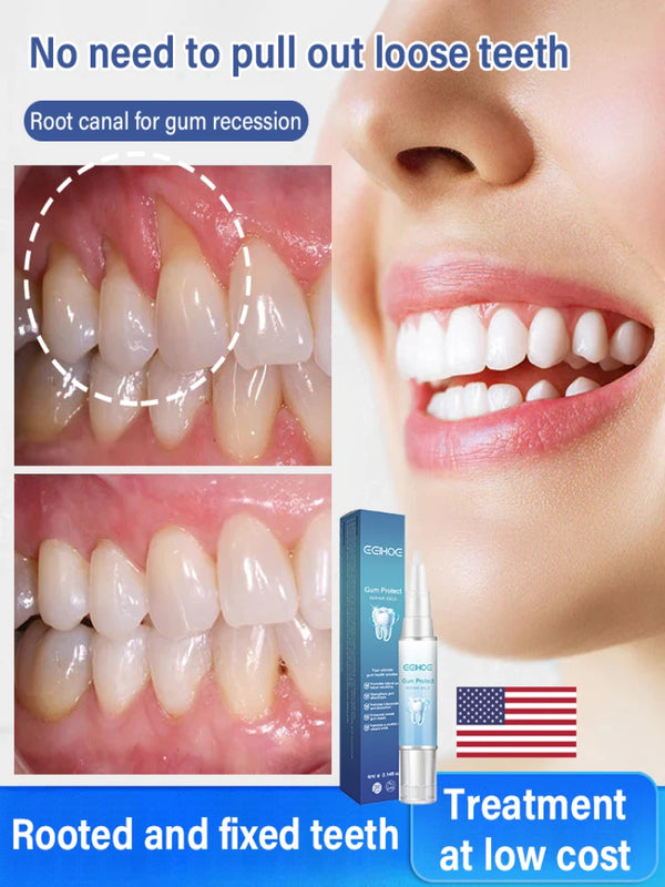 Whitening Smile Gel